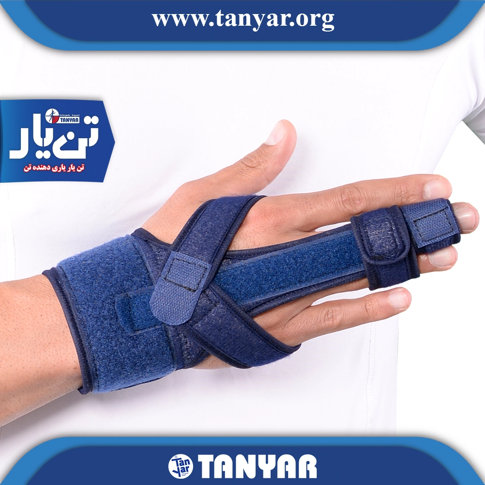 آتل انگشت دست و پا - تصویر 3