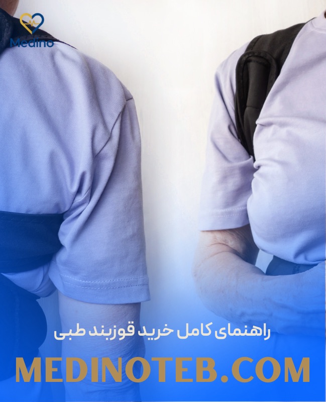راهنمای کامل خرید قوزبند طبی؛ چگونه بهترین قوزبند را انتخاب کنیم؟